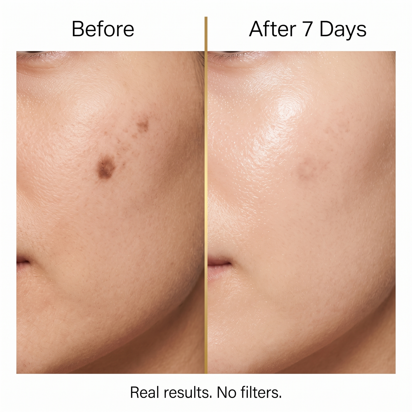 Dark Spot Serum Patch