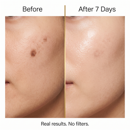 Dark Spot Serum Patch