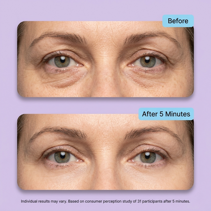 Instant Lift Eye Gel